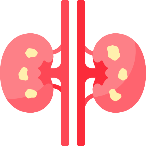kidney stone surgery in Faridabad