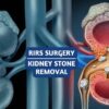 Recover Faster from Kidney Stones